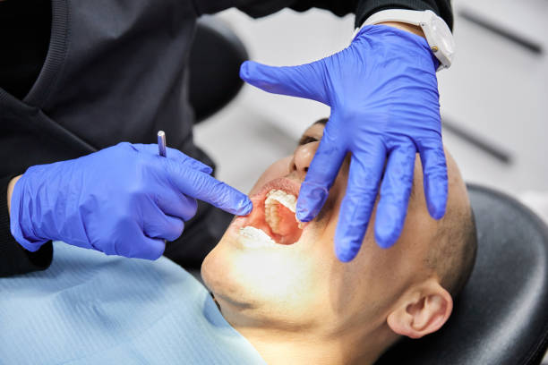 Best Emergency Gum Treatment in North Palm Beach, FL